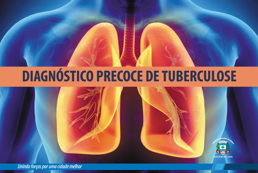 Prefeitura intensifica busca ativa de pacientes com tuberculose