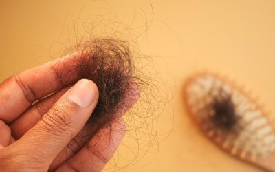 Queda de cabelo: o que é aceitável e o que sinaliza alterações no organismo